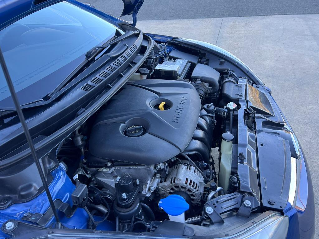 2016 Hyundai Elantra SE photo